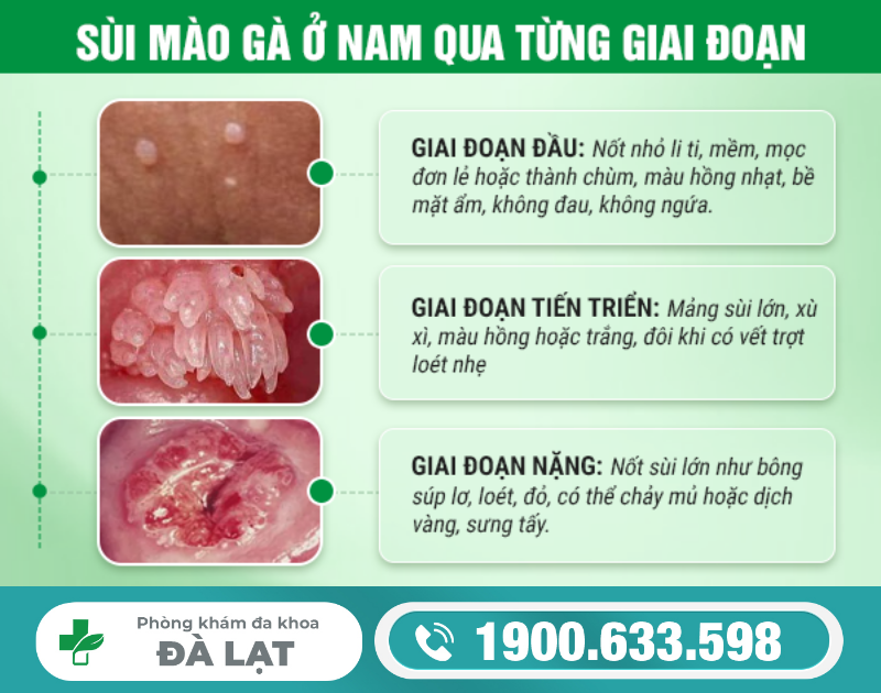 Hình ảnh minh họa